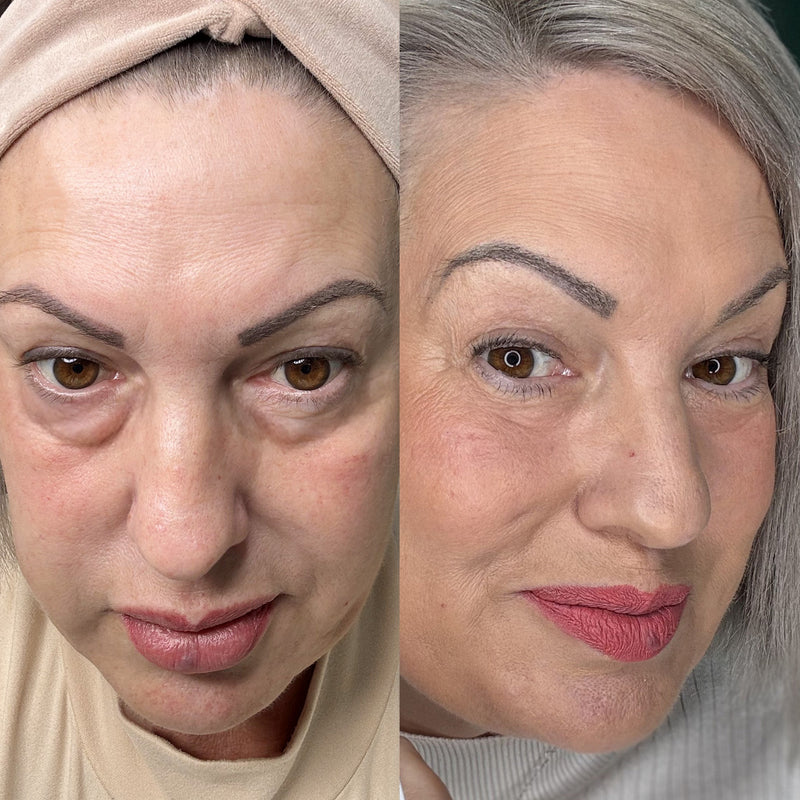 Visibly reduced dark circles